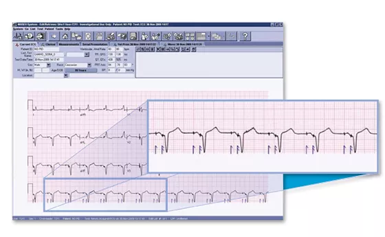 product-product-categories-diagnostic-ecg-cardio data-muse v9-clinical-expertise
