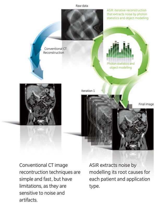 product-product-categories-pet-ct-asir-asir_technology_graphic.jpg
