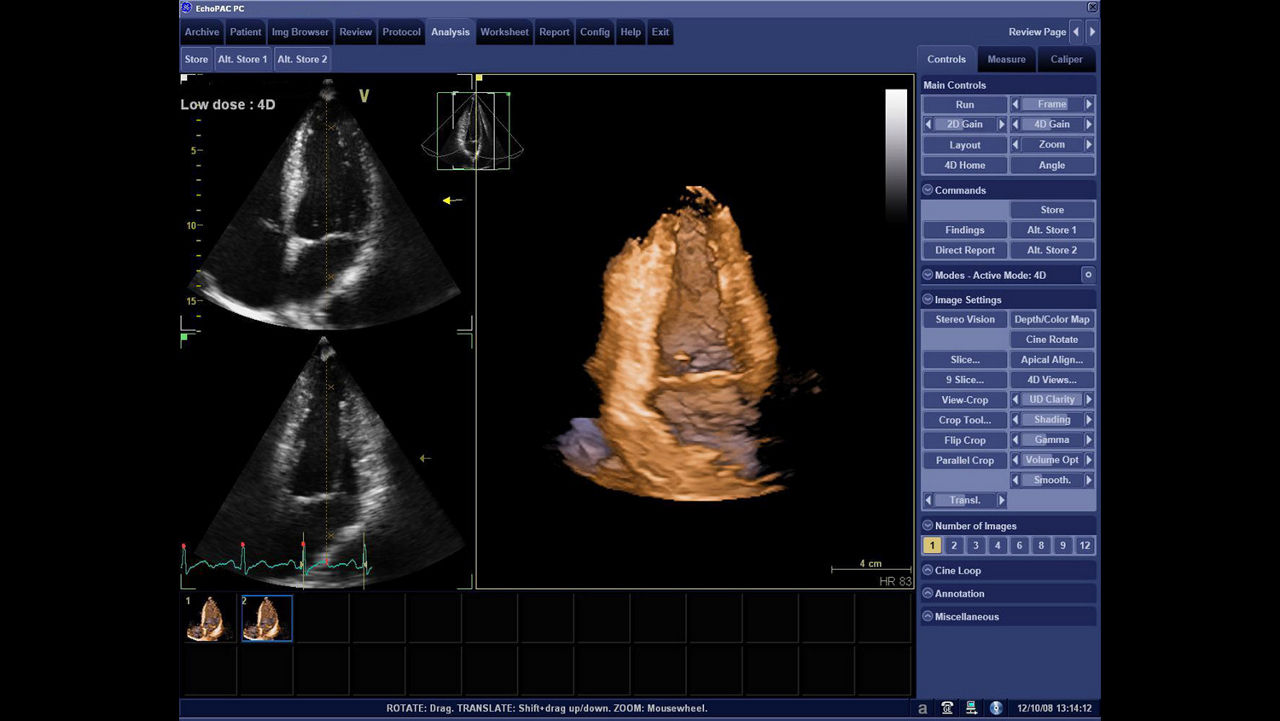 product-product-categories-ultrasound-echopac-echopac_advanced_analysis_technology.jpg