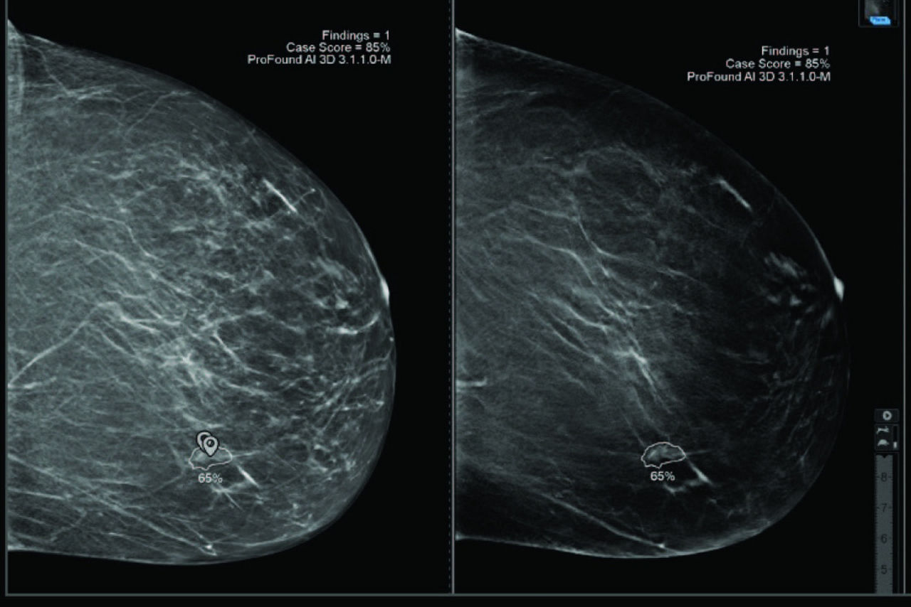 profound-ai-feature-hero-desktop