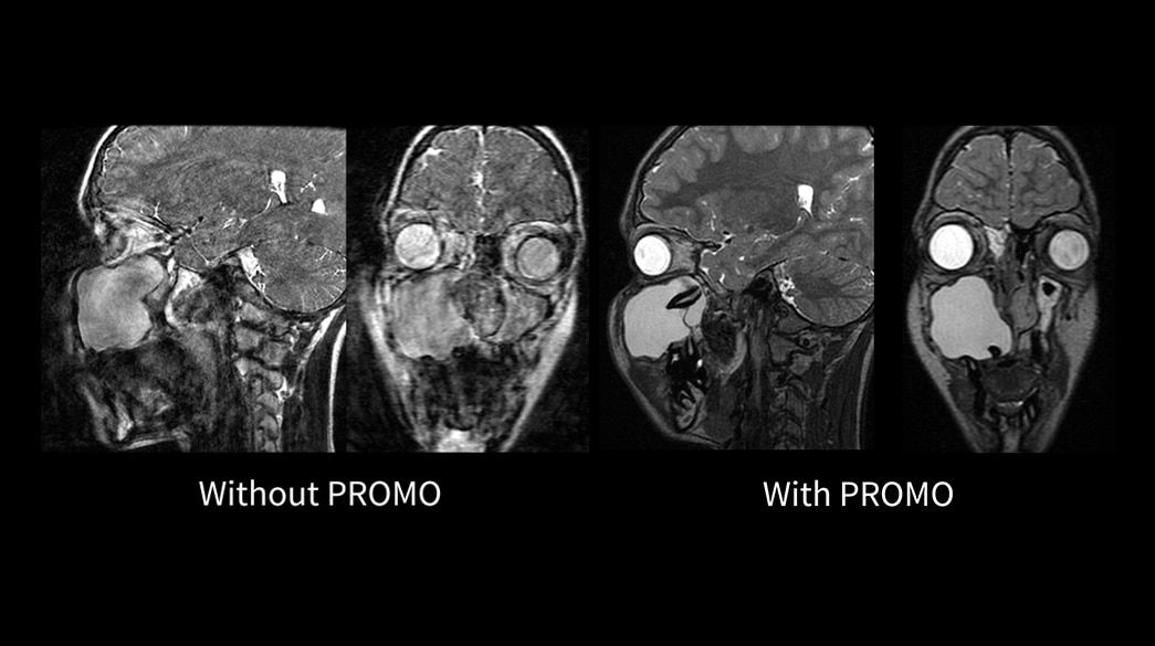 <p>PROMO - Compatible with AIR™ Recon DL</p>
