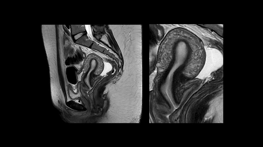 <p>PROPELLER - Compatible with AIR™ Recon DL</p>
