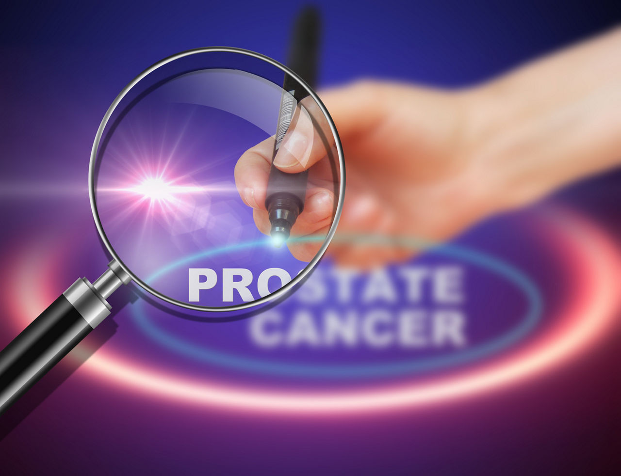 prostate-cancer