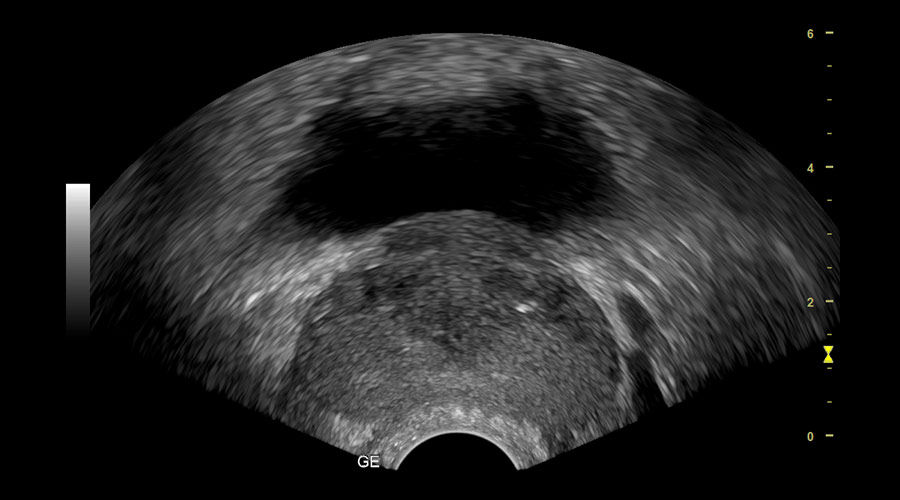 prostate-imaging