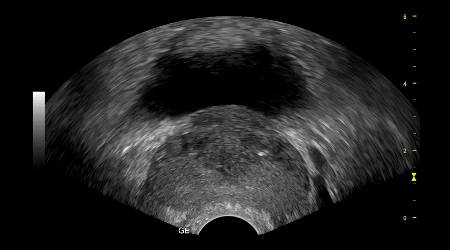 prostate-imaging