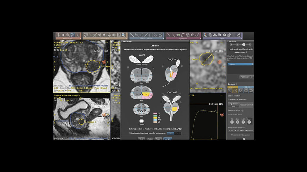 PROView-DL1040-x-585