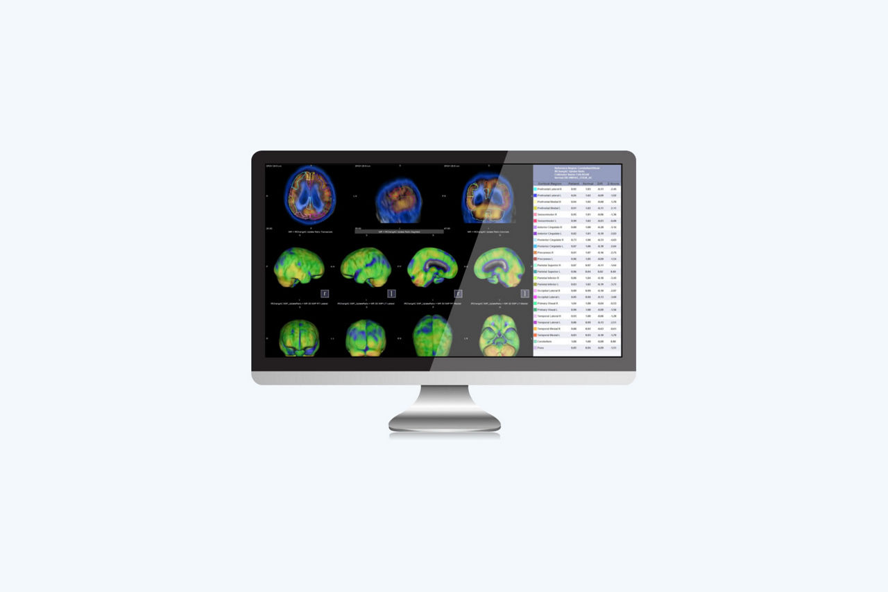 q-brain
