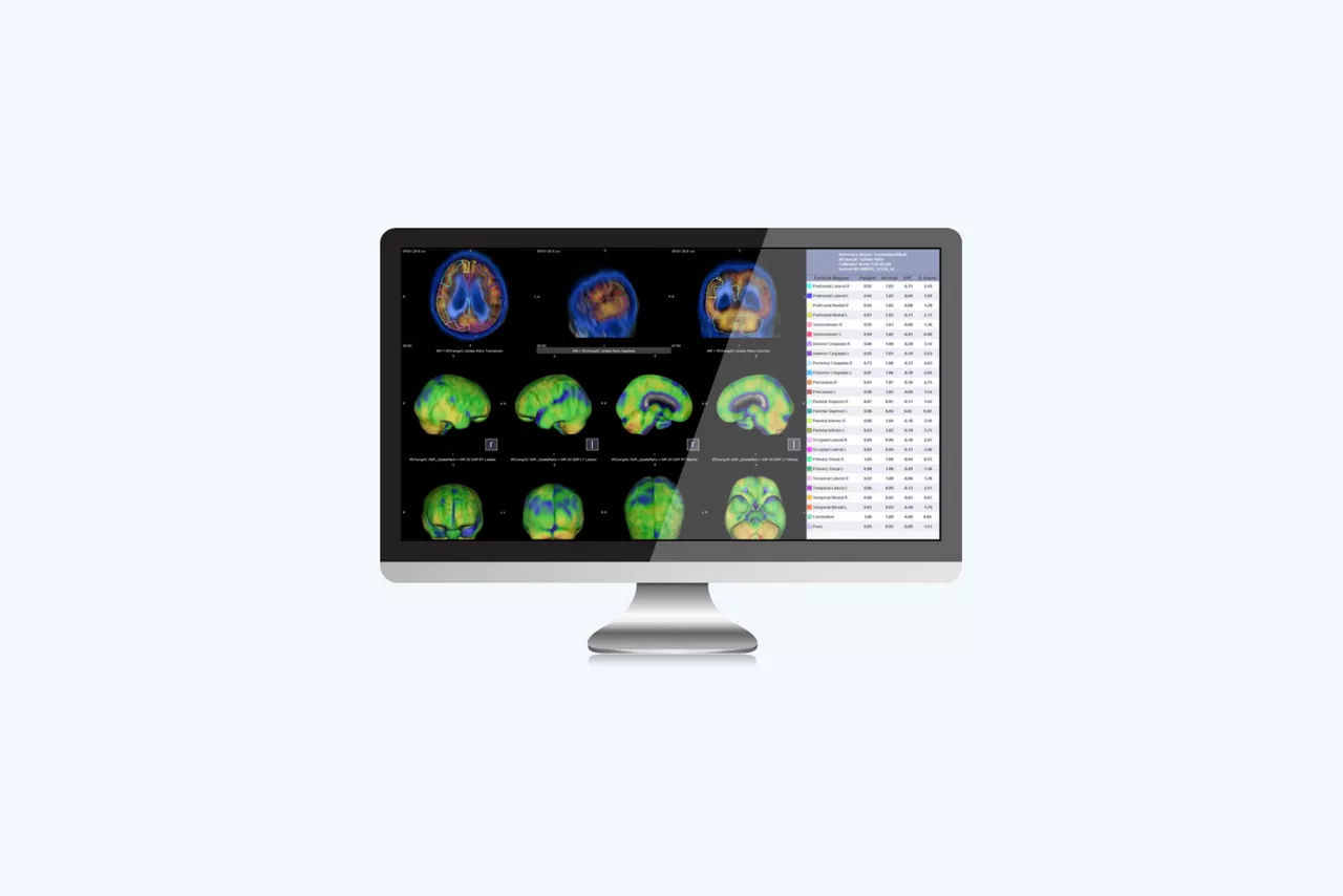 q-brain