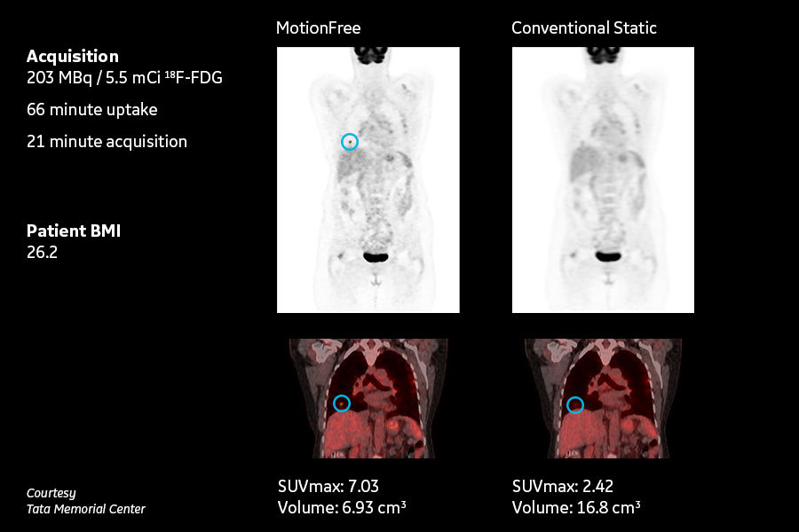 QuantitationImage4