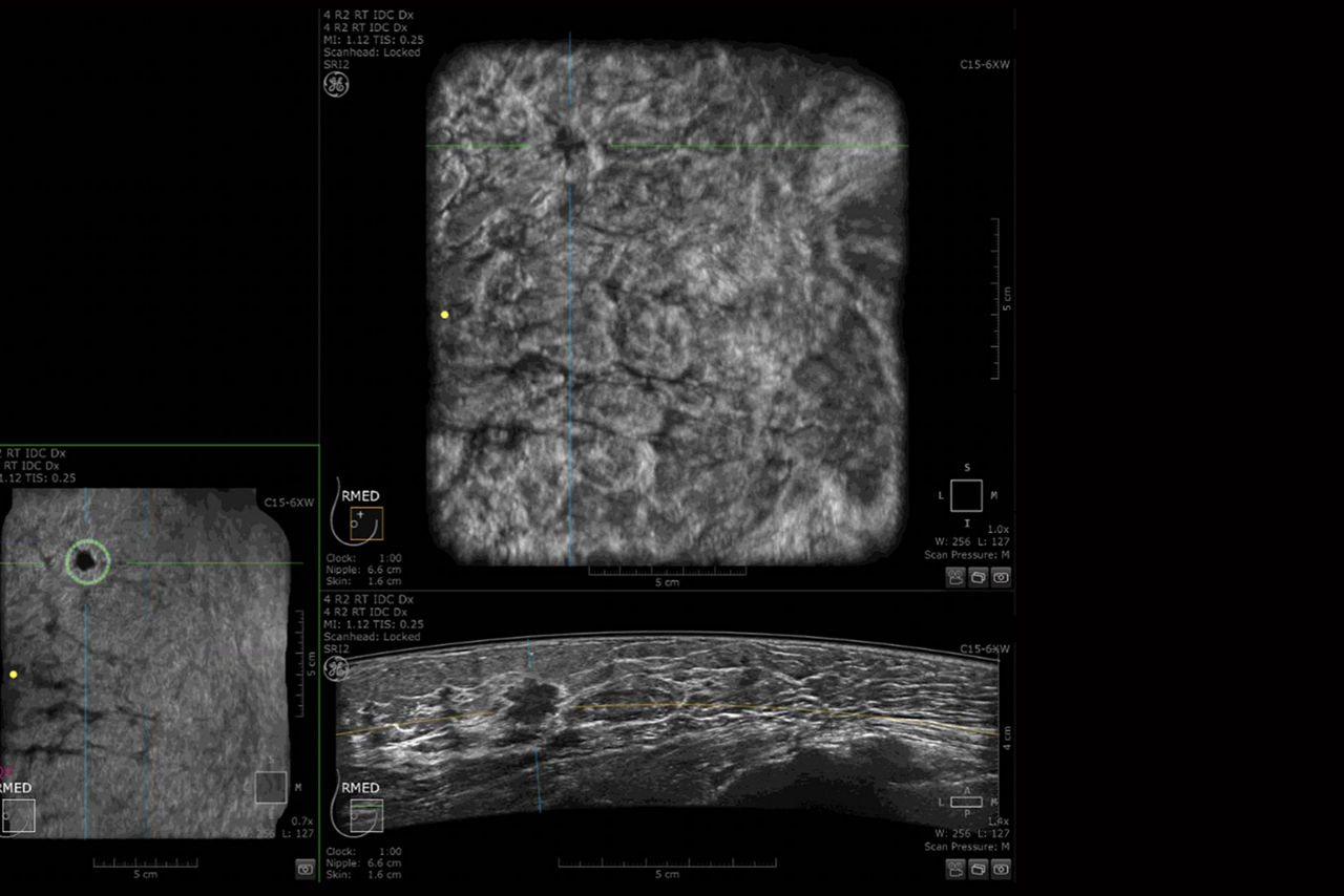 QViewCADLayout2_pdp-feature-hero-template_1650x1100