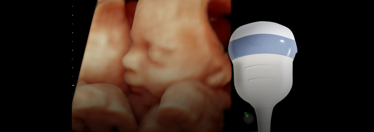 RAB2-6-RS-probe