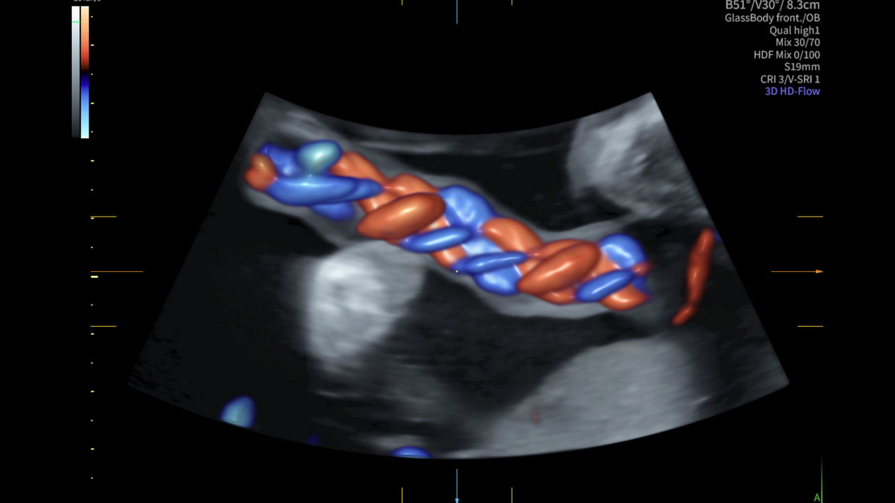 Radiantflow-EXP22 -RAB7-OB-3D-HDFRF-VCI-VSRI-image