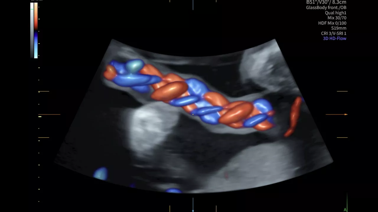 radiantflow-exp22--rab7-ob-3d-hdfrf-vci-vsri-image-ci-en