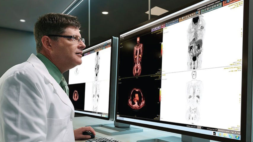 radiation-oncology-brochure-mobile