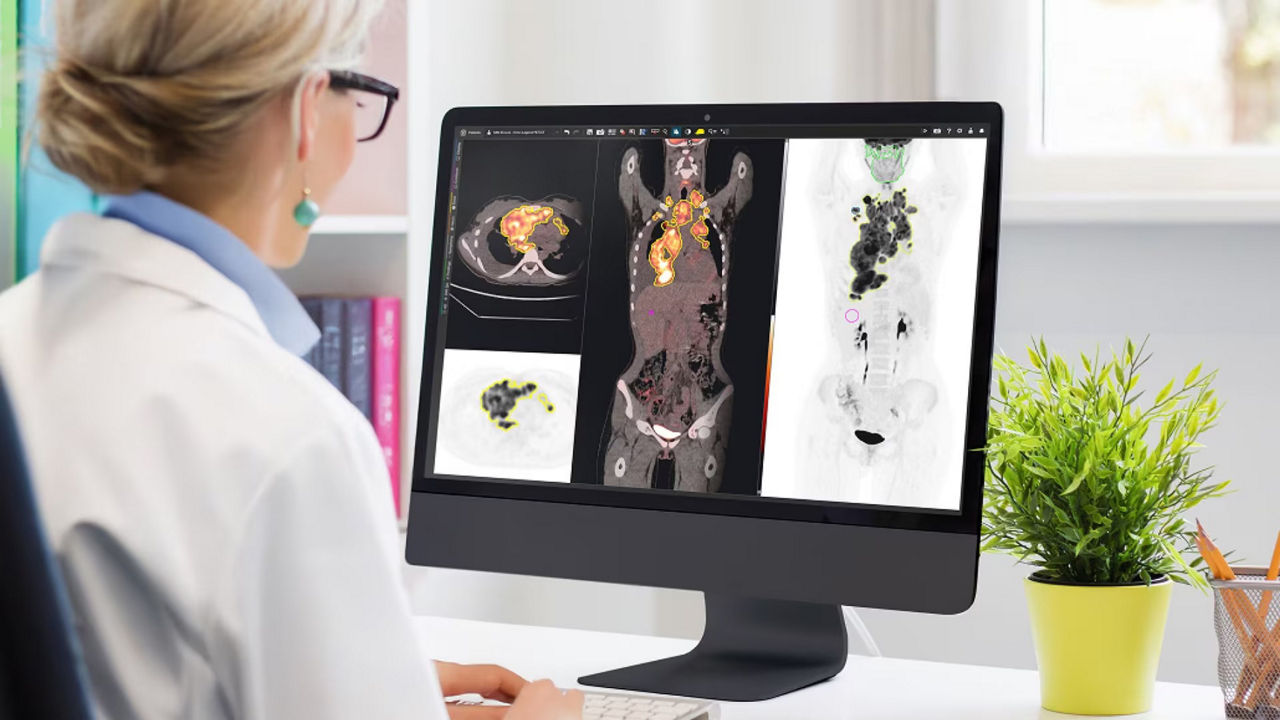 radiation-oncology-ct-solutions-productsw2-st-en