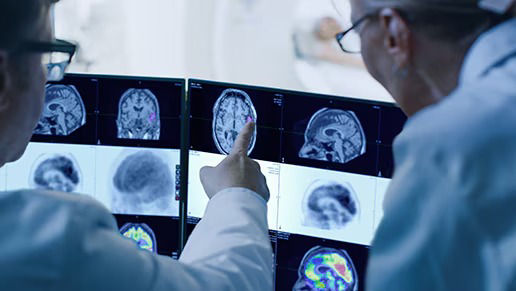 Clinicians reviewing brain imaging scans on a multi-screen display, discussing findings used in oncology diagnosis and treatment planning.