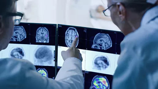 Clinicians reviewing brain imaging scans on a multi-screen display, discussing findings used in oncology diagnosis and treatment planning.