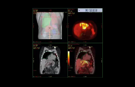 Radiation-Oncology-Solutions_s-curve05