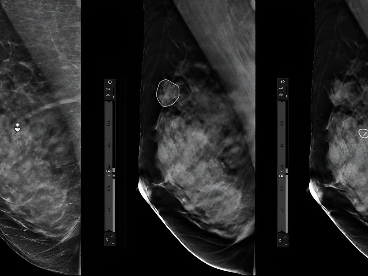 radiologists-work-smarter-ArticleHero-ci-en