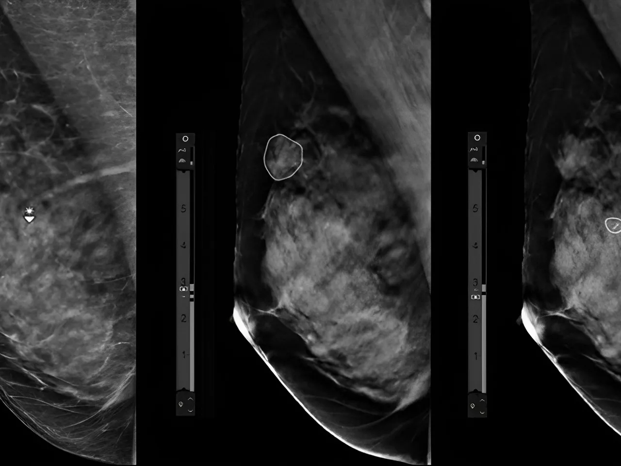 radiologists-work-smarter-ArticleHero-ci-en