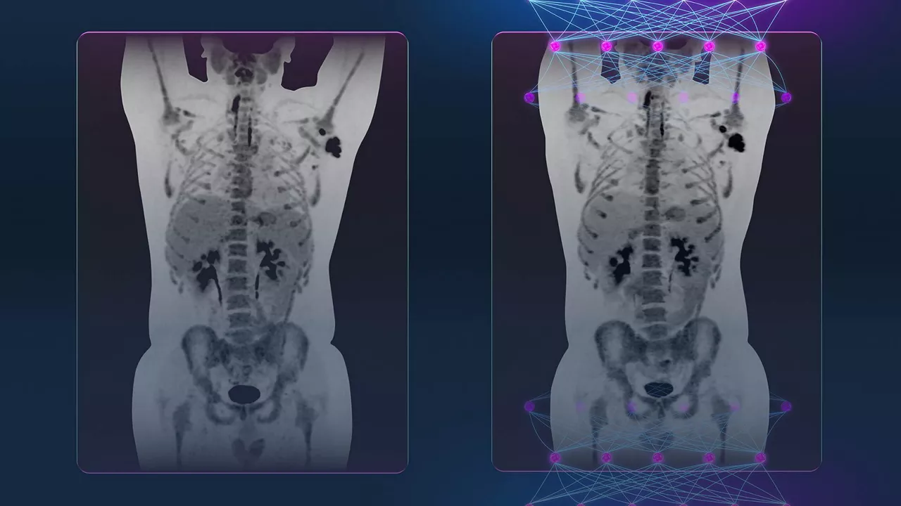 content card image