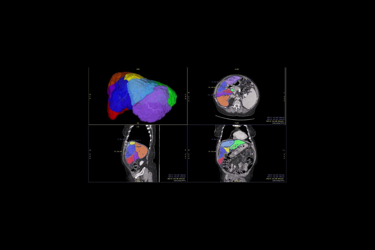 reading-workflow-solution-ci-en