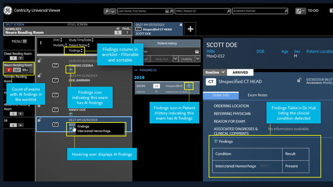 centricity universal viewer interface