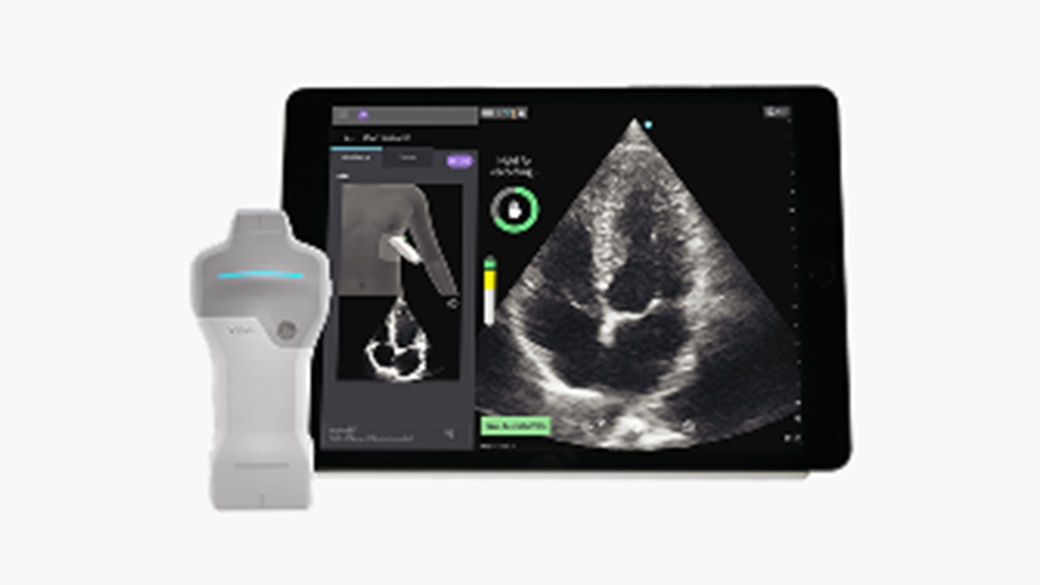 Vscan Air™ SL with Caption AI™.