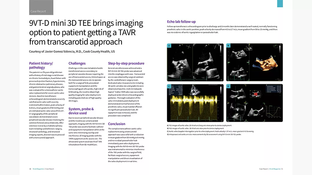 Article cover page with medical images.