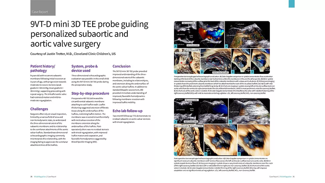 Case report with images.
