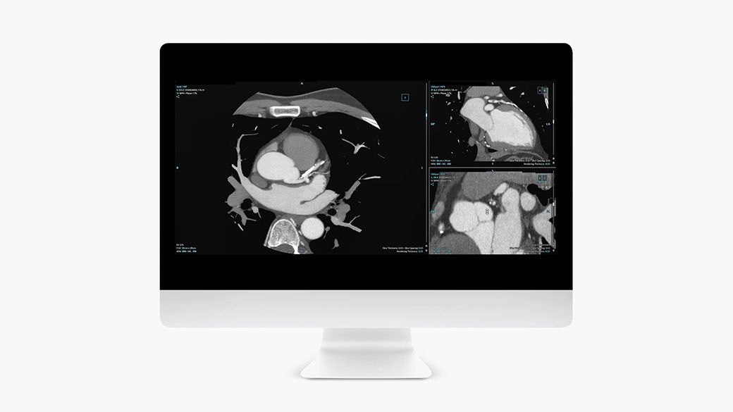 Image of a computer monitor showing a CardIQ Suite tool.