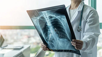 Clinician viewing x-ray of patient lungs