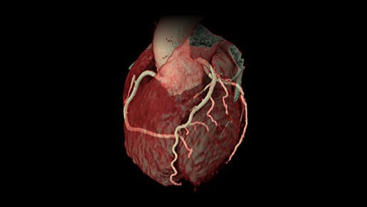 Image of a heart.