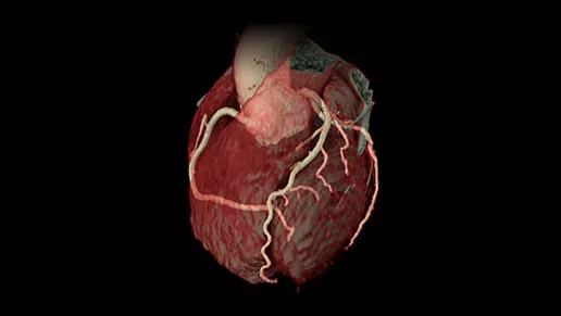 Image of a heart.