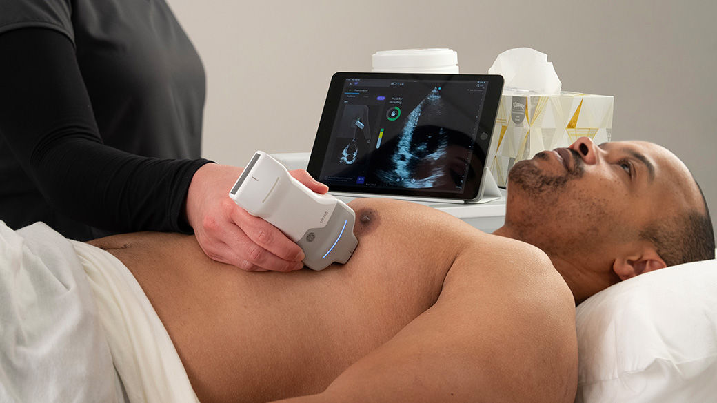 Image of a clinician using AI in a bedside Echo Lab assessment.