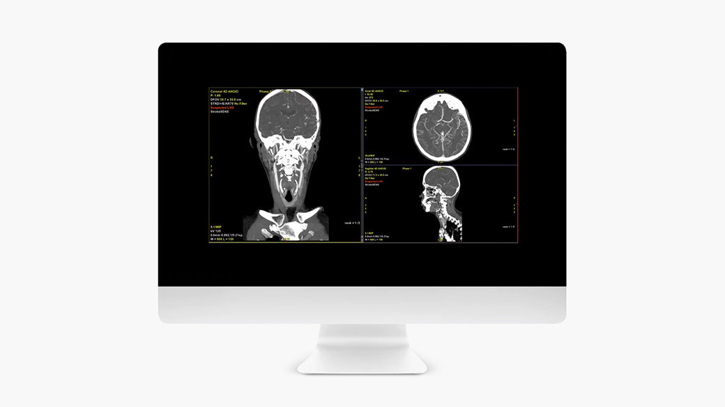 Image of a computer monitor showing a FastStroke tool.