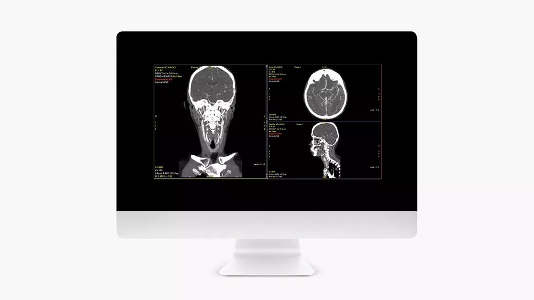 Image of a computer monitor showing a FastStroke tool.