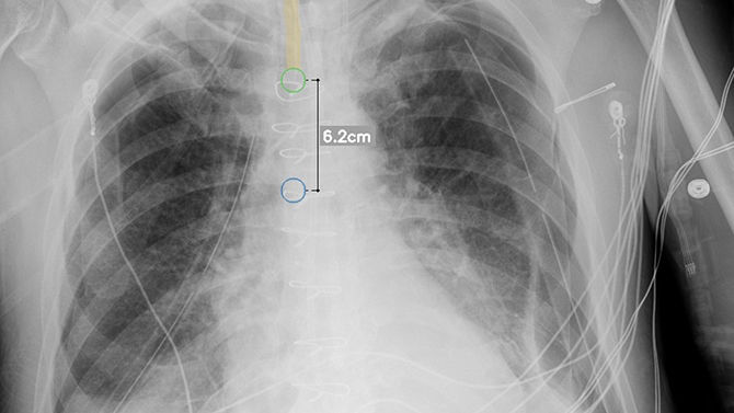 Support radiology staff with intelligent X-ray efficiencies