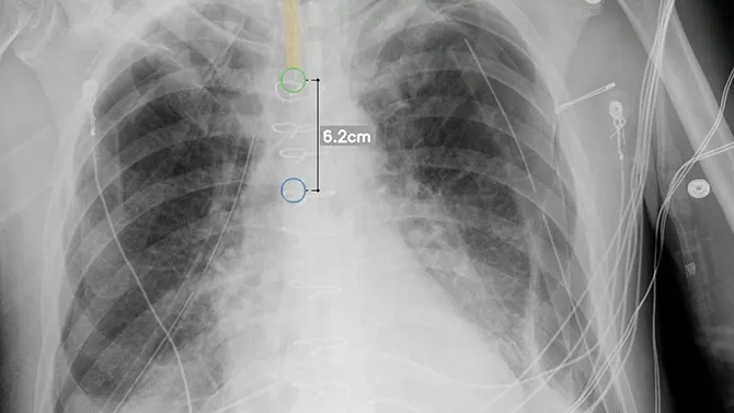 Support radiology staff with intelligent X-ray efficiencies