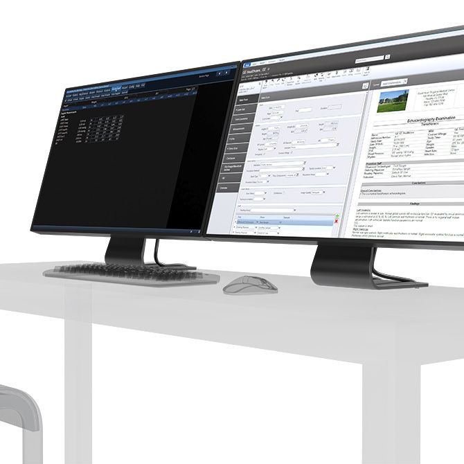 EchoPAC software on computer monitors