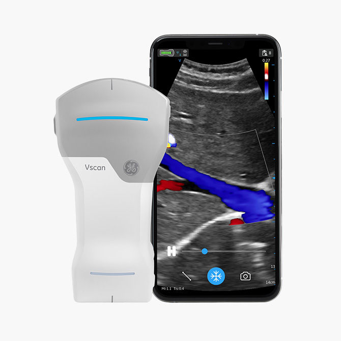 Vscan Air handheld ultrasound