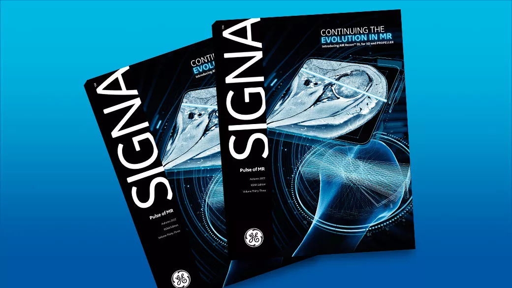 SIGNA Pulse