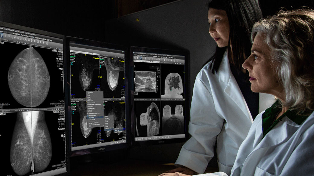 two women looking at radiology images on two monitors