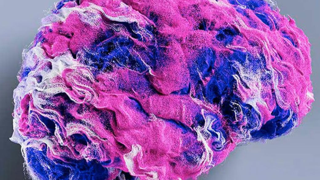 AIR Recon DL visualization.