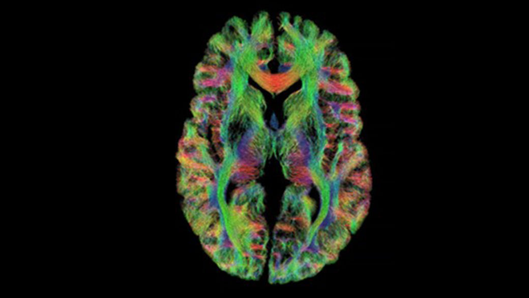 X-ray AI clinical applications