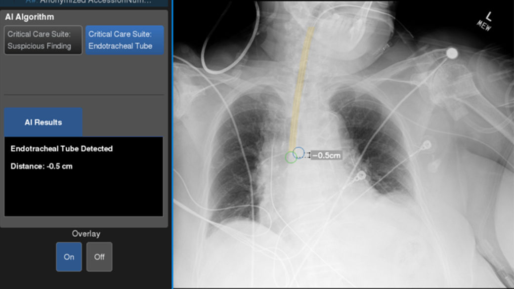 Next gen fixed X-ray system: Definium™ Tempo