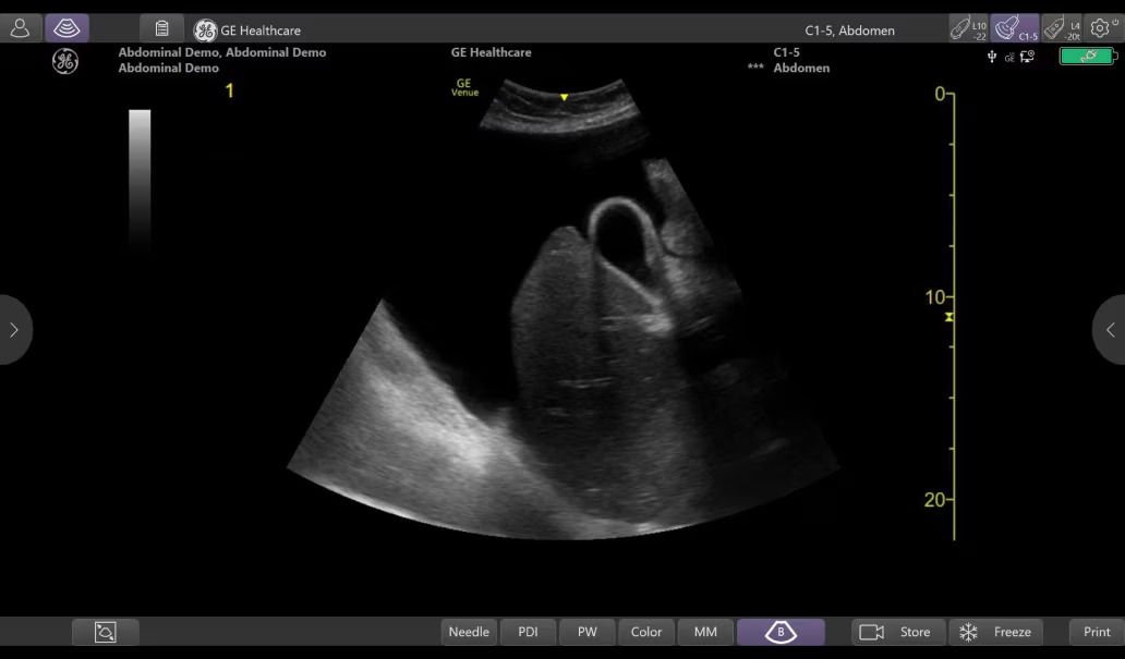 remove-the-clutter-with-simple-screen-ci-en