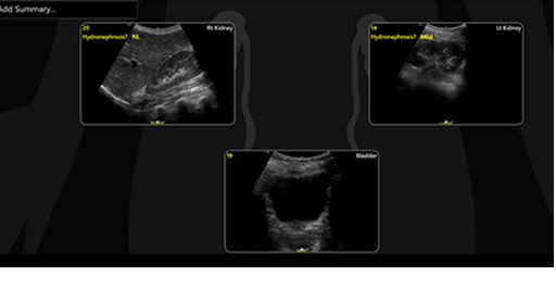 renal-diagram-review-desktop cropped