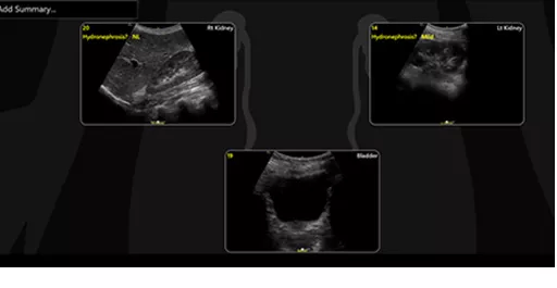 renal-diagram-review-desktop cropped