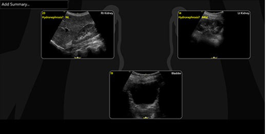 renal-diagram-review-desktop-updated